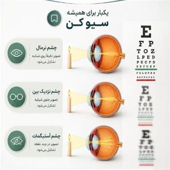 تفاوت دید چشم نرمال،چشم نزدیک بین،چشم آستیگمات