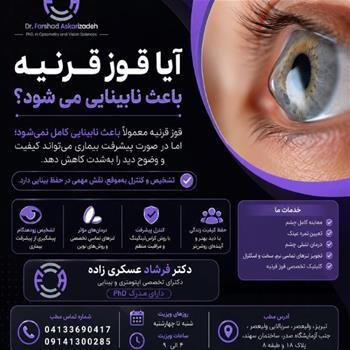 قوز قرنیه و نابینایی ؛ هر آنچه باید بدانید