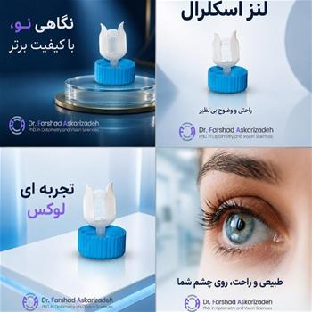 لنز اسکلرال ؛ نگاهی نو به راحتی و وضوح دید.
